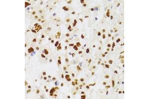 Immunohistochemistry (Paraffin-embedded Sections) (IHC (p)) image for anti-Nuclear Autoantigenic Sperm Protein (Histone-Binding) (NASP) (AA 180-449) antibody (ABIN6144374)