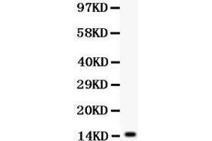Anti- IL15 antibody, Western blotting All lanes: Anti IL15  at 0. (IL-15 抗体  (AA 49-162))