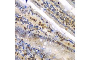 Immunohistochemistry of paraffin-embedded mouse Intestine using SYNCRIP antibody.