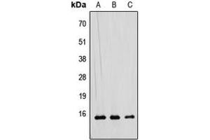 Western blot analysis of RAD52B expression in HEK293T (A), Raw264. (RDM1 抗体  (Center))