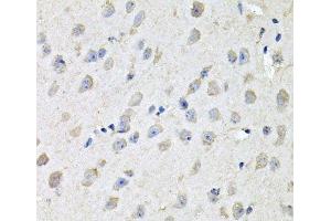 Immunohistochemistry of paraffin-embedded Mouse brain using CHCHD3 Polyclonal Antibody at dilution of 1:100 (40x lens). (CHCHD3 抗体)