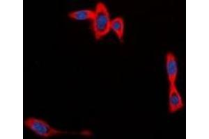 Immunofluorescent analysis of CYB561D1 staining in MCF7 cells. (CYB561D1 抗体  (C-Term))