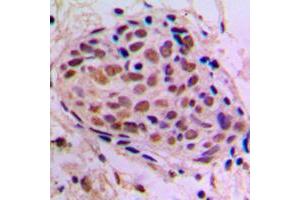 Immunohistochemistry (IHC) image for anti-cAMP Responsive Element Binding Protein 1 (CREB1) (Center) antibody (ABIN7295354)