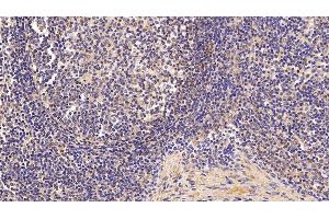 Immunohistochemistry (IHC) image for anti-Serpin Family A Member 7 (SERPINA7) (AA 128-415) antibody (ABIN7429163)