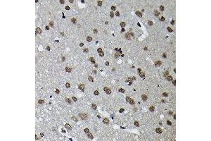 Immunohistochemistry of paraffin-embedded rat brain using Cyclin K Rabbit pAb (ABIN6128996, ABIN6138098, ABIN6138099 and ABIN6214445) at dilution of 1:100 (40x lens). (Cyclin K 抗体  (AA 1-160))