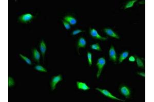 Immunofluorescent analysis of Hela cells using ABIN7166275 at dilution of 1:100 and Alexa Fluor 488-congugated AffiniPure Goat Anti-Rabbit IgG(H+L) (VAC14 抗体  (AA 333-523))