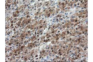 Image no. 5 for anti-Aminoacylase 1 (ACY1) antibody (ABIN1496452)