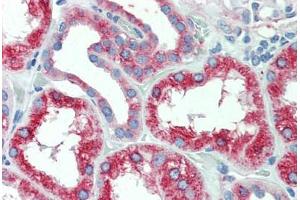 Immunohistochemistry (IHC) image for anti-Solute Carrier Family 11 (Proton-Coupled Divalent Metal Ion Transporters), Member 2 (SLC11A2) (Internal Region) antibody (ABIN1049329)
