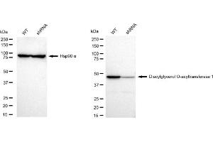 anti-Diacylglycerol O-Acyltransferase 1 (DGAT1) antibody