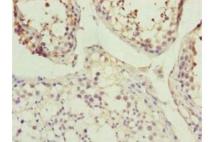 Immunohistochemistry of paraffin-embedded human testis tissue using ABIN7157235 at dilution of 1:100 (KANSL3 抗体  (AA 1-200))