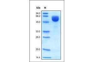 Human BACE-1, His Tag on SDS-PAGE under reducing (R) condition. (BACE1 Protein (AA 22-457) (His tag))