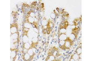 Immunohistochemistry of paraffin-embedded Human rectum using MYO5A Polyclonal Antibody at dilution of 1:100 (40x lens). (MYO5A 抗体)