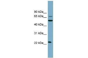 WB Suggested Anti-CLEC6A Antibody Titration:  0.