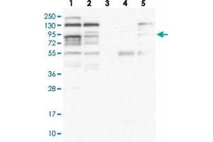 Western blot analysis of Lane 1: RT-4, Lane 2: U-251 MG, Lane 3: Human Plasma, Lane 4: Liver, Lane 5: Tonsil with ZNF227 polyclonal antibody  at 1:100-1:250 dilution. (ZNF227 抗体)