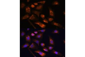 Immunofluorescence (IF) image for anti-Ribosomal Protein S13 (RPS13) (AA 79-151) antibody (ABIN7270012)