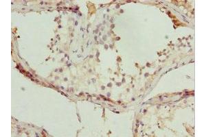 Immunohistochemistry of paraffin-embedded human testis tissue using ABIN7171567 at dilution of 1:100 (TBPL1 抗体  (AA 1-186))