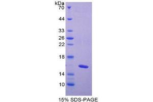 SDS-PAGE (SDS) image for Fibroblast Growth Factor 2 (Basic) (FGF2) (AA 67-196) protein (His tag) (ABIN1980759)