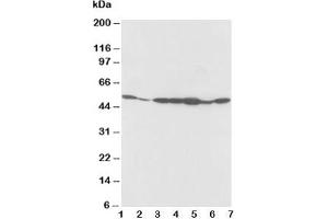 Western blot testing of alpha 2a Adrenergic Receptor antibody and Lane 1:  rat testis;  2: rat brain;  3: MCF-7;  4: MM453;  5: SMMC-7721;  6: HeLa;  7: COLO320 cell lysate (ADRA2A 抗体  (C-Term))