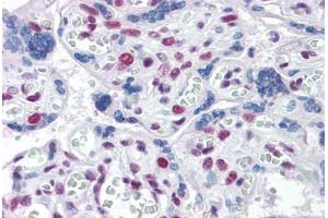 Immunohistochemistry (Formalin-fixed Paraffin-embedded Sections) (IHC (fp)) image for anti-Topoisomerase I Binding, arginine/serine-Rich, E3 Ubiquitin Protein Ligase (TOPORS) (AA 98-206) antibody (ABIN574418)