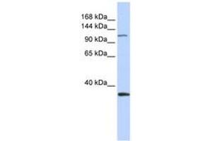 Image no. 1 for anti-Minichromosome Maintenance Complex Component 2 (MCM2) (AA 828-877) antibody (ABIN6742706) (MCM2 抗体  (AA 828-877))