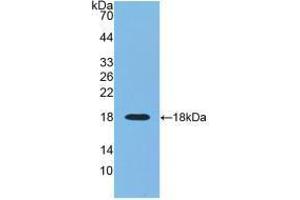 Western blot analysis of recombinant Human RNASE3. (RNASE3 抗体  (AA 30-154))