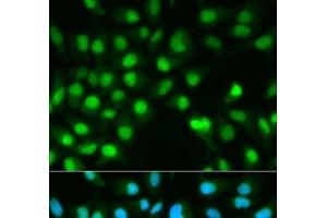 Immunofluorescence analysis of HeLa cells using PPP3CA Polyclonal Antibody (PPP3CA 抗体)