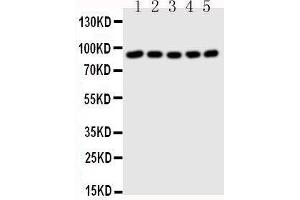 Western Blotting (WB) image for anti-Signal Transducer and Activator of Transcription 1, 91kDa (STAT1) (AA 736-750), (C-Term) antibody (ABIN3043178) (STAT1 抗体  (C-Term))