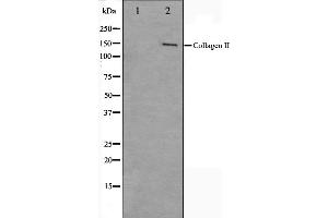 Western blot analysis on COLO205 cell lysate using Collagen II Antibody,The lane on the left is treated with the antigen-specific peptide. (COL2A1 抗体  (N-Term))