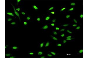 Immunofluorescence of purified MaxPab antibody to MCM4 on HeLa cell. (MCM4 抗体  (AA 1-863))