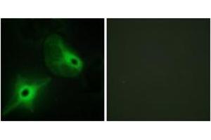 Immunofluorescence analysis of HeLa cells, using KSR2 Antibody. (KSR2 抗体  (AA 671-720))