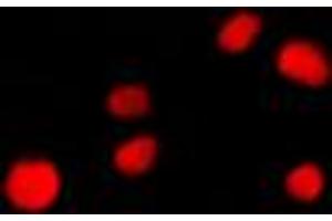 Immunofluorescent analysis of NUP160 staining in NIH3T3 cells. (NUP160 抗体  (Center))