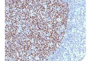 Immunohistochemistry (IHC) image for anti-B-Cell CLL/lymphoma 6 (BCL6) (AA 256-389) antibody (ABIN6940529)