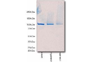 SDS-PAGE/Coomassie Blue staining of poly(ADP-ribose) automodified PARP1. (PARP1 蛋白)