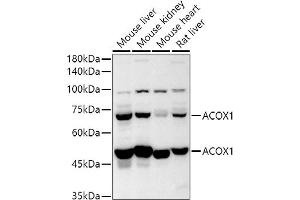 Western blot analysis of extracts of various cell lines, using  antibody (ABIN6131168, ABIN6136442, ABIN6136443 and ABIN6224114) at 1:500 dilution. (ACOX1 抗体  (AA 1-270))