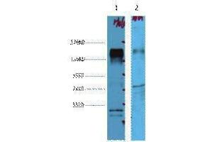 Western Blotting (WB) image for anti-Receptor tyrosine-protein kinase erbB-2 (ErbB2/Her2) antibody (ABIN3178598) (ErbB2/Her2 抗体)
