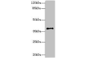 Western blot All lanes: PLCXD1 antibody at 2 μg/mL + Jurkat whole cell lysate Secondary Goat polyclonal to rabbit IgG at 1/10000 dilution Predicted band size: 37 kDa Observed band size: 37 kDa (PLCXD1 抗体  (AA 1-323))