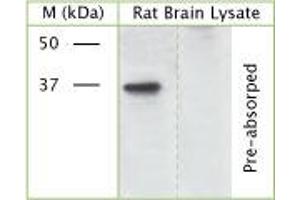 WB on rat brain lysate using Rabbit antibody to phospho S41 of Axonal membrane protein GAP-43 (Neuromodulin, growth-associated protein 43): IgG (ABIN350110) at 50 µg/ml concentration incubated overnight at 4°C. (GAP43 抗体  (pSer41))