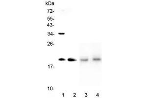 Western blot testing of 1) human HeLa, 2) human placenta, 3) rat lung and 4) mouse lung lysate with Dermatopontin antibody at 0. (Dermatopontin 抗体  (AA 19-201))