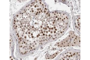 Immunohistochemistry (IHC) image for anti-Serum Response Factor (SRF) (pSer99) antibody (ABIN6255577)