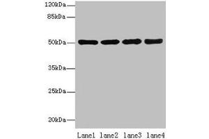 Western blot All lanes: CEACAM1 antibody at 10 μg/mL Lane 1: HT29 whole cell lysate Lane 2: HCT116 whole cell lysate Lane 3: COLO205 whole cell lysate Lane 4: HepG2 whole cell lysate Secondary Goat polyclonal to rabbit IgG at 1/10000 dilution Predicted band size: 58, 46, 36, 39, 51, 47, 28, 44, 52, 40 kDa Observed band size: 51 kDa (CEACAM1 抗体  (AA 35-428))
