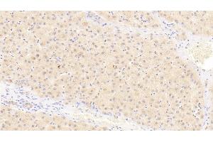 Detection of IL23a in Human Liver Tissue using Polyclonal Antibody to Interleukin 23 Subunit Alpha (IL23a) (IL23A 抗体  (AA 20-189))