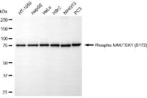 anti-TANK-Binding Kinase 1 (TBK1) (pSer172) antibody