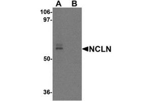 Western blot analysis of NCLN in mouse heart tissue lysate with NCLN antibody at 0.