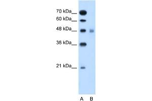 WB Suggested Anti-SLC17A4 Antibody Titration:  0. (SLC17A4 抗体  (Middle Region))