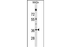 Western blot analysis in WiDr cell line lysates (35ug/lane). (ALG5 抗体  (AA 74-100))