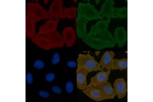 ABIN6257709 and ABIN6275139 staining Hela cells(30 min of UV treatment) by IF/ICC. (GABRD 抗体  (Internal Region))