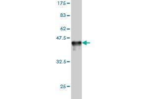 Western Blot detection against Immunogen (36. (RAD23A 抗体  (AA 151-250))