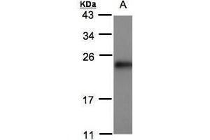 WB Image Sample(30 μg of whole cell lysate) A:MOLT4, 15% SDS PAGE antibody diluted at 1:500 (SRI 抗体)