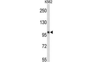 Western Blotting (WB) image for anti-Heat Shock 105kDa/110kDa Protein 1 (HSPH1) antibody (ABIN3001677) (HSPH1 抗体)