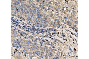 IHC analysis of RPL17 using anti-RPL17 antibody (ABIN7601639). (RPL17 抗体  (AA 40-167))